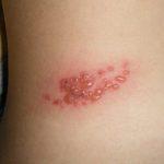 Giời leo - giời ăn